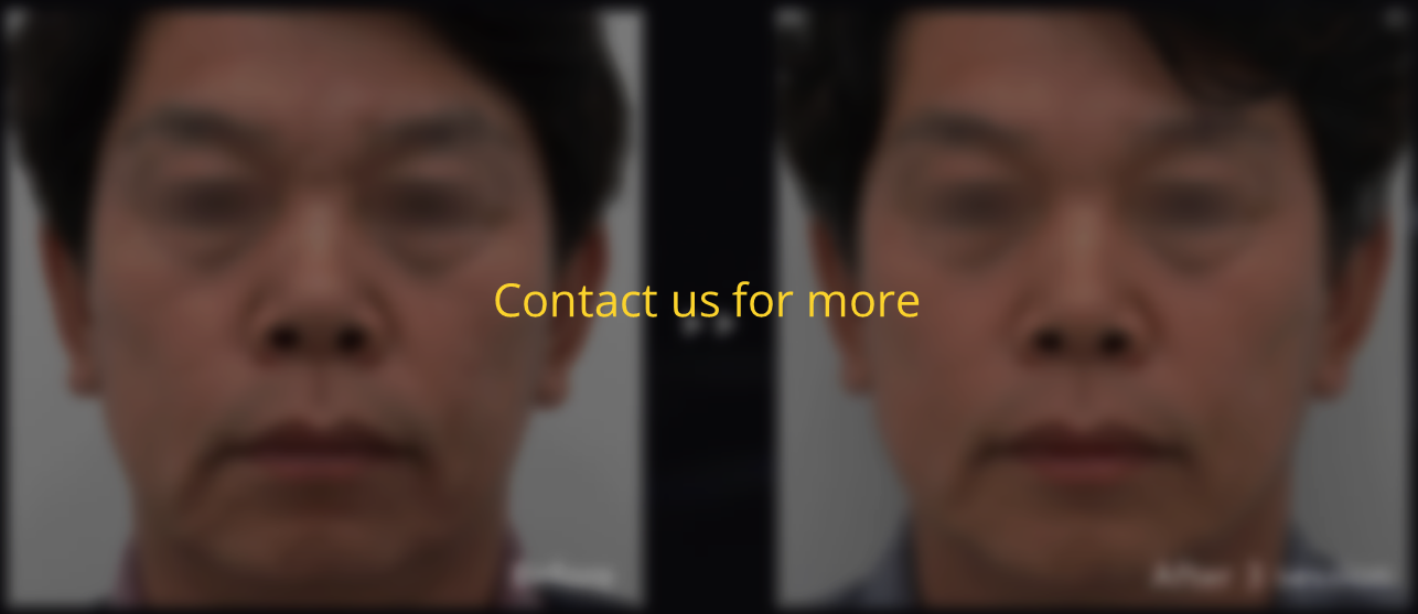 ino3